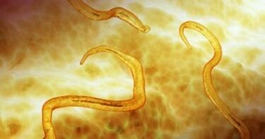 pinworm პარაზიტები ადამიანის სხეულში